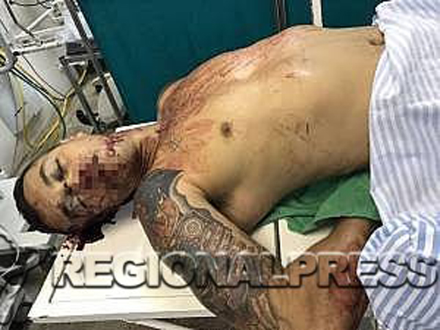 Emerson Benedito tem várias tatuagens pelo corpo, entre elas a do “Palhaço” (que é um símbolo macabro de ódio das polícias). Foto: Divulgação