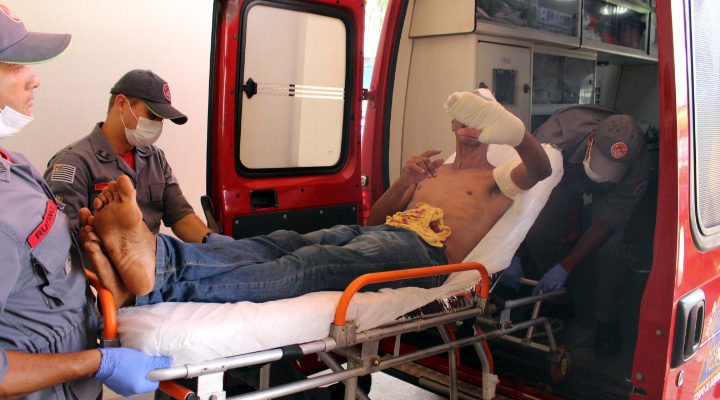 Homem foi atingido com golpes na mão e braço esquerdos, além da cabeça. Foto: Manoel Messias/Mil Noticias