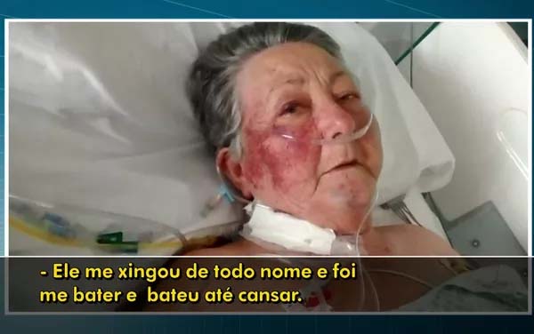 Paciente relata ter sido agredida por enfermeiro do Hospital do Servidor Público Municipal (Foto: TV Globo/Reprodução).