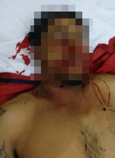 José Veríssimo da Silva Filho de 31 anos, foi morto com tiros no tórax, pescoço e costas. foto: Minuto MS