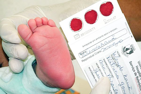 Saiba como funciona o Teste do Pezinho e quais doenças ele detecta. Foto: Portabebe.net