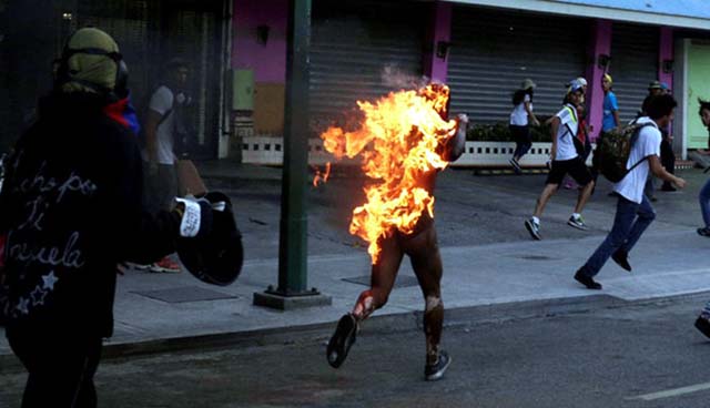 Orlando Figuera, de 21 anos, era manifestante pró-governo e teve seu corpo queimado (Foto: Reuters/Marco Bello)