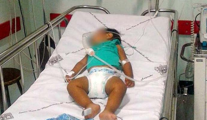 Criança segue internada em estado grave na UTI pediátrica da Santa Casa de Araçatuba. (Regional Press)