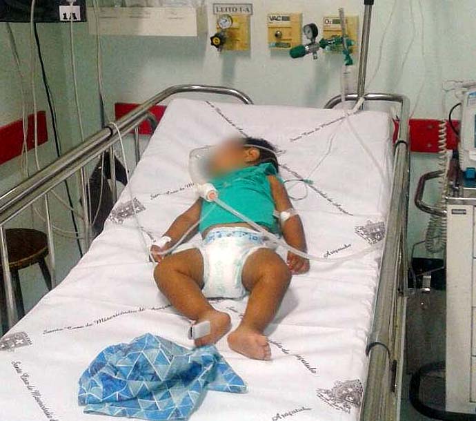 Criança segue internada em estado grave na UTI pediátrica da Santa Casa de Araçatuba. (Regional Press)