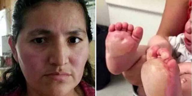 Ismelda Ramos Mendoza, 36 anos, é acusada de queimar os pés de uma bebê de apenas 6 meses. Foto: NBC4.