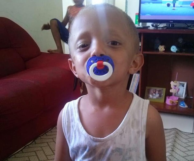 Menino de 2 anos morreu atropelado dentro de condomínio (Foto: Arquivo Pessoal).
