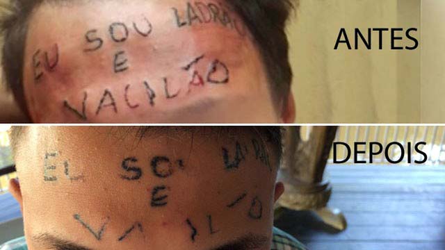 Remoção de tatuagem feita por dupla presa por tortura de jovem em São Bernardo (Foto: Glauco Araújo/G1)