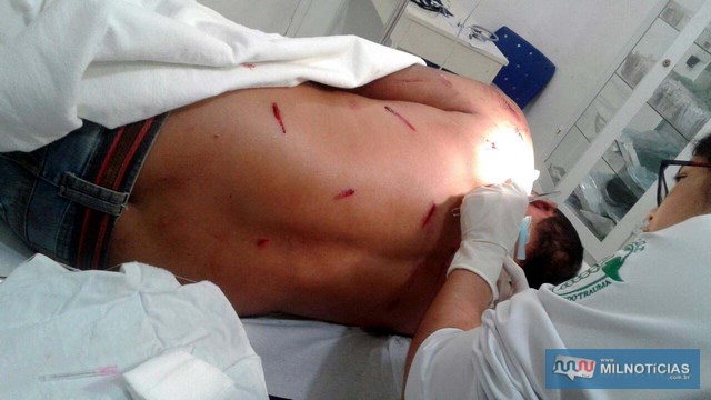 Vigilante apresentava ferimentos no rosto, tórax e principalmente nas costas. Foto: DIVULGAÇÃO