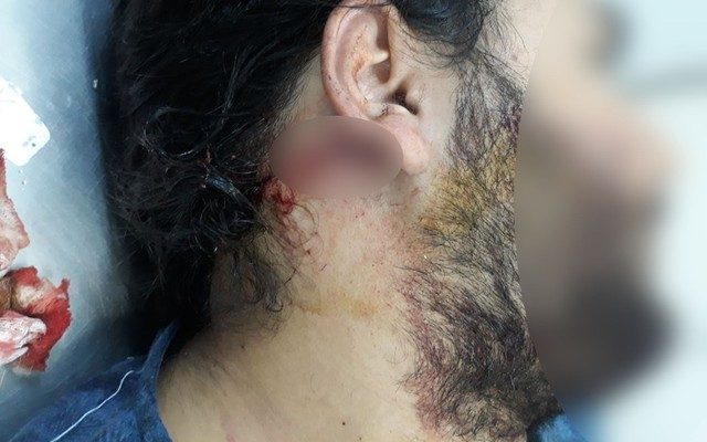 Motorista de aplicativo reage a assalto e é baleado no rosto após corrida em MT (Foto: Arquivo pessoal).