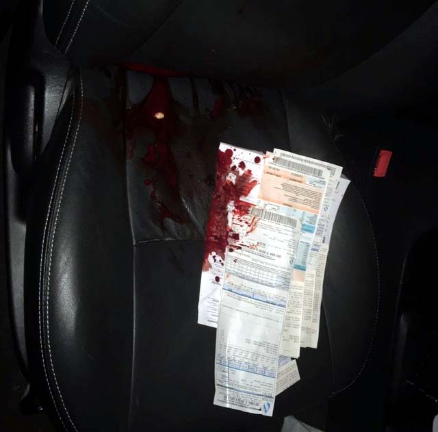Banco do carro do prefeito baleado ficou com manchas de sangue em MS (Foto: Polícia Civil/Divulgação)