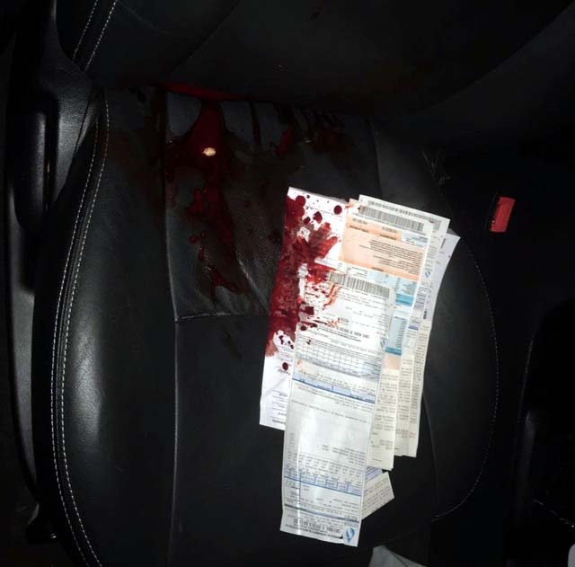 Banco do carro do prefeito baleado ficou com manchas de sangue em MS (Foto: PolÃcia Civil/Divulgação)