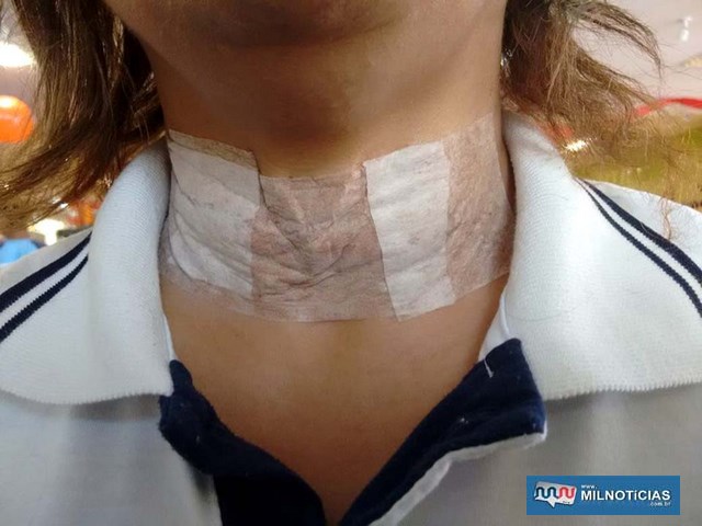 Mulher sofreu corte no pescoço provocado por linha com cerol. Foto: DIVULGAÇÃO
