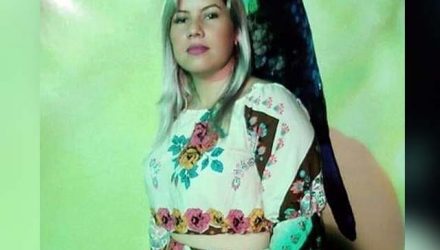 Suelen Karine Camilo, de 29 anos, foi golpeada em casa e teve traumatismo craniano. Foto: Reprodução