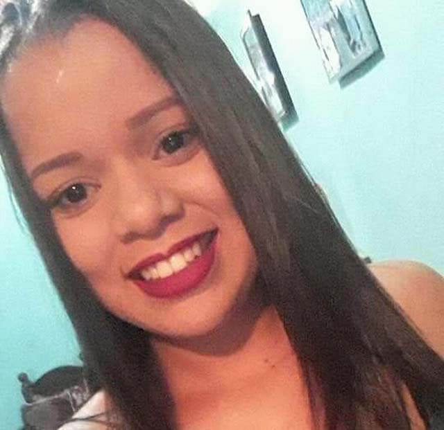 Mayara Estefanny teve rosto queimado pelo ex-marido, no Recife — Foto: Reprodução/TV Globo.