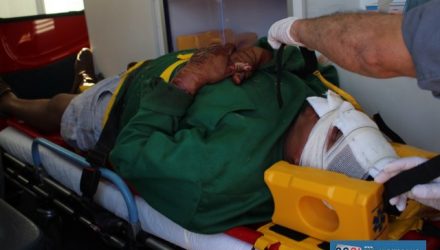 Vítima sofreu um grande corte na testa, outros menores na face, além de suspeita de fratura no nariz. Fotos MANOEL MESSIAS/Agência