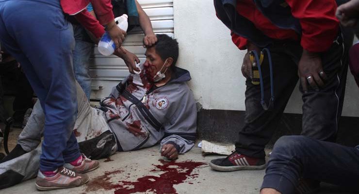 Manifestante ferido em operação da polícia e exército para acabar com um ato em uma refinaria na cidade de El Alto, na Bolívia, em 19 de novembro de 2019 — Foto: Pablo Aneli/Reuters.