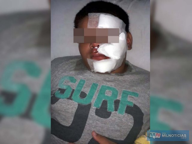 Criança sofreu ferimentos gravíssimos no rosto, além da perda de um dente. Foto: Arquivo de Família