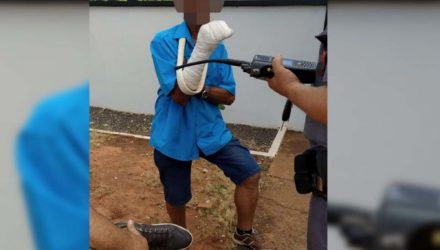 Armador de ferragens sofreu fratura em um dos dedos da mão direita, além de escoriações no rosto, Foto: MANOEL MESSIAS/Agência