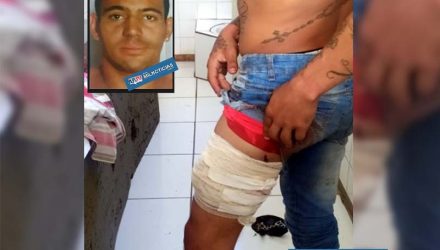 Matheus Reze Gomes, o “Bred”, foi ferido quando reagia a tentativa de abordagem da PM; Foi indiciado por tentativa de homicídio. Foto: DIVULGAÇÃO