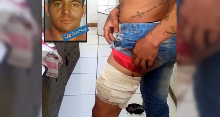 Matheus Reze Gomes, o “Bred”, foi ferido quando reagia a tentativa de abordagem da PM; Foi indiciado por tentativa de homicídio. Foto: DIVULGAÇÃO