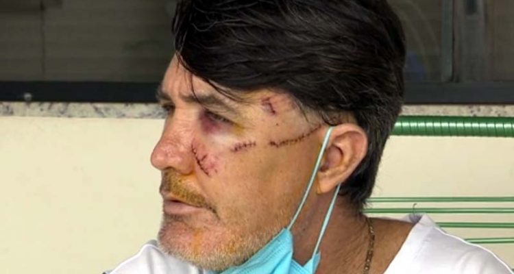 Odair Righi Reganham foi atacado por cães da raça pitbull — Foto: Reprodução/TV Fronteira