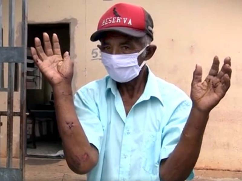 João Gama da Silva estava andando de bicicleta quando foi atacado pelos cães — Foto: Reprodução/TV Fronteira