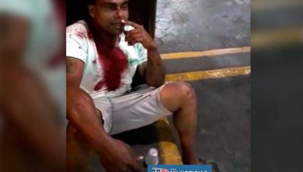 Servente de pedreiro A. S. L., o “Nê”, de 34 anos, morador no Jardim Alvorada, foi violentamente agredido na madrugada de sábado (18). Foto: Arquivo Pessoal