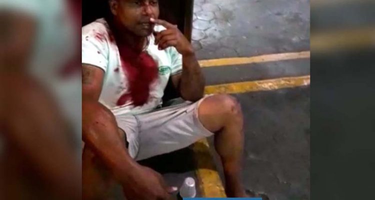 Servente de pedreiro A. S. L., o “Nê”, de 34 anos, morador no Jardim Alvorada, foi violentamente agredido na madrugada de sábado (18). Foto: Arquivo Pessoal