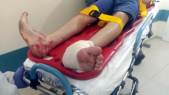 Funcionário do frigorífico sofreu fratura do tornozelo esquerdo, além de escoriações pelo corpo. Foto: MANOEL MESSIAS/Agência