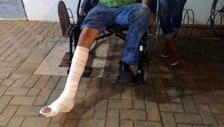 Adolescente de 17 anos sofreu fratura em um osso da canela da perna direita, além de escoriações e contusões pelo corpo. Foto: MANOEL MESSIAS/Agência