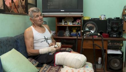 Catador de recicláveis de 71 anos teve perna amputada após ser atacado por dois pit bulls em Ribeirão Preto — Foto: Carlos Trinca/EPTV