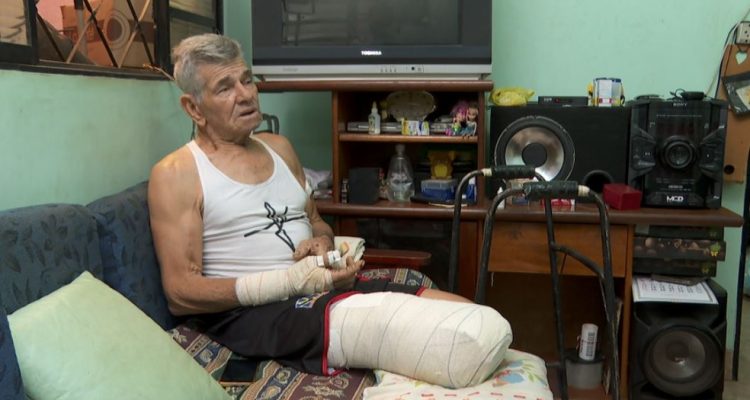 Catador de recicláveis de 71 anos teve perna amputada após ser atacado por dois pit bulls em Ribeirão Preto — Foto: Carlos Trinca/EPTV