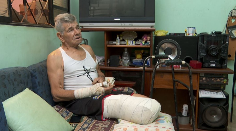Catador de recicláveis de 71 anos teve perna amputada após ser atacado por dois pit bulls em Ribeirão Preto — Foto: Carlos Trinca/EPTV