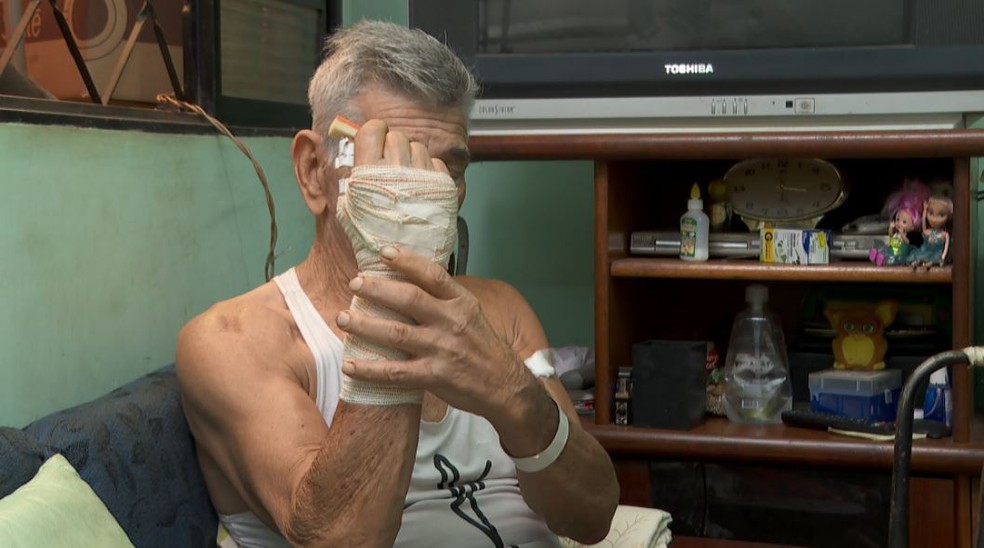 Catador de recicláveis de 71 anos sofreu ferimento nos braços ao ser atacado por dois pit bulls em Ribeirão Preto — Foto: Carlos Trinca/EPTV