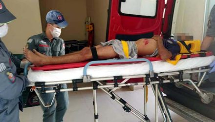 Piloto da Titan 160cc, sofreu escoriações generalizadas pelo corpo, traumatismo toráxico e craniano leve, além de suspeita de fratura de costelas, lado esquerdo. Foto: MANOEL MESSIAS/Agência