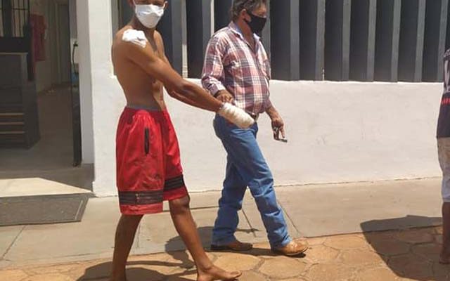 Agressor apresentava lesões na mão, ombro e parte interna da orelha, todos do lado direito. Foto: MANOEL MESSIAS/Agência