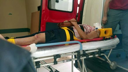 Dona de casa sofreu fratura do joelho esquerdo, além de diversas escoriações e contusões pelo corpo. Foto: MANOEL MESSIAS/Agência