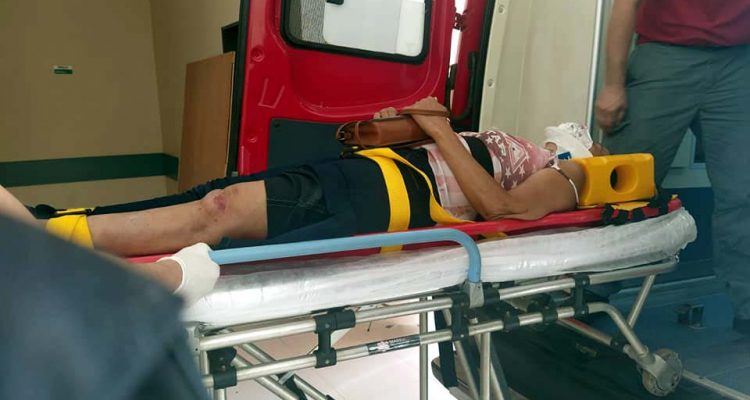Dona de casa sofreu fratura do joelho esquerdo, além de diversas escoriações e contusões pelo corpo. Foto: MANOEL MESSIAS/Agência