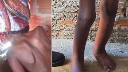 Menino de 11 anos vivia acorrentado dentro de um tonel nos fundos da residência da família, em Campinas. Foto: DIVULGAÇÃO