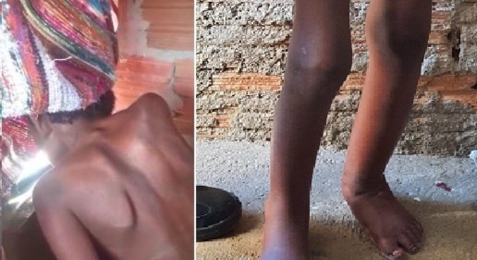 Menino de 11 anos vivia acorrentado dentro de um tonel nos fundos da residência da família, em Campinas. Foto: DIVULGAÇÃO