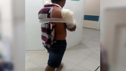 Vítima apresentava 3 perfurações de tiros no ombro direito, permanecendo internado. Foto: MANOEL MESSIAS/Agência