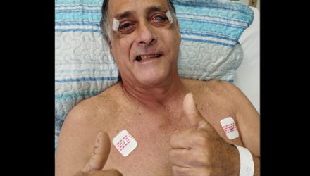 Ronaldo Rafachinho vem se recuperando do grave acidente com moto. Foto: Arquivo Pessoal