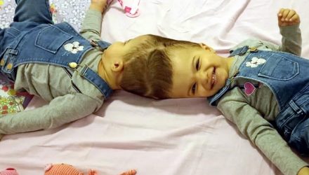 As gêmeas Allana e Mariah são acompanhadas pelo Hospital das Clínicas de Ribeirão Preto, SP — Foto: Divulgação HC Ribeirão