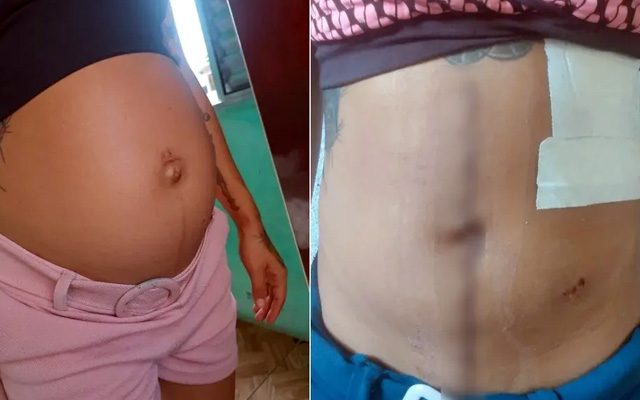 Elizabeth precisou passar por cesárea para retirar a bebê após ataque em Praia Grande (SP) — Foto: Arquivo pessoal