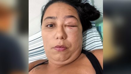 Mulher havia sido violentamente agredida em ocorrência anterior e a prisão do acusado é um alívio. Foto cedida pela vítima