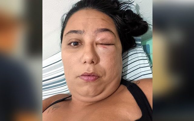 Mulher havia sido violentamente agredida em ocorrência anterior e a prisão do acusado é um alívio. Foto cedida pela vítima